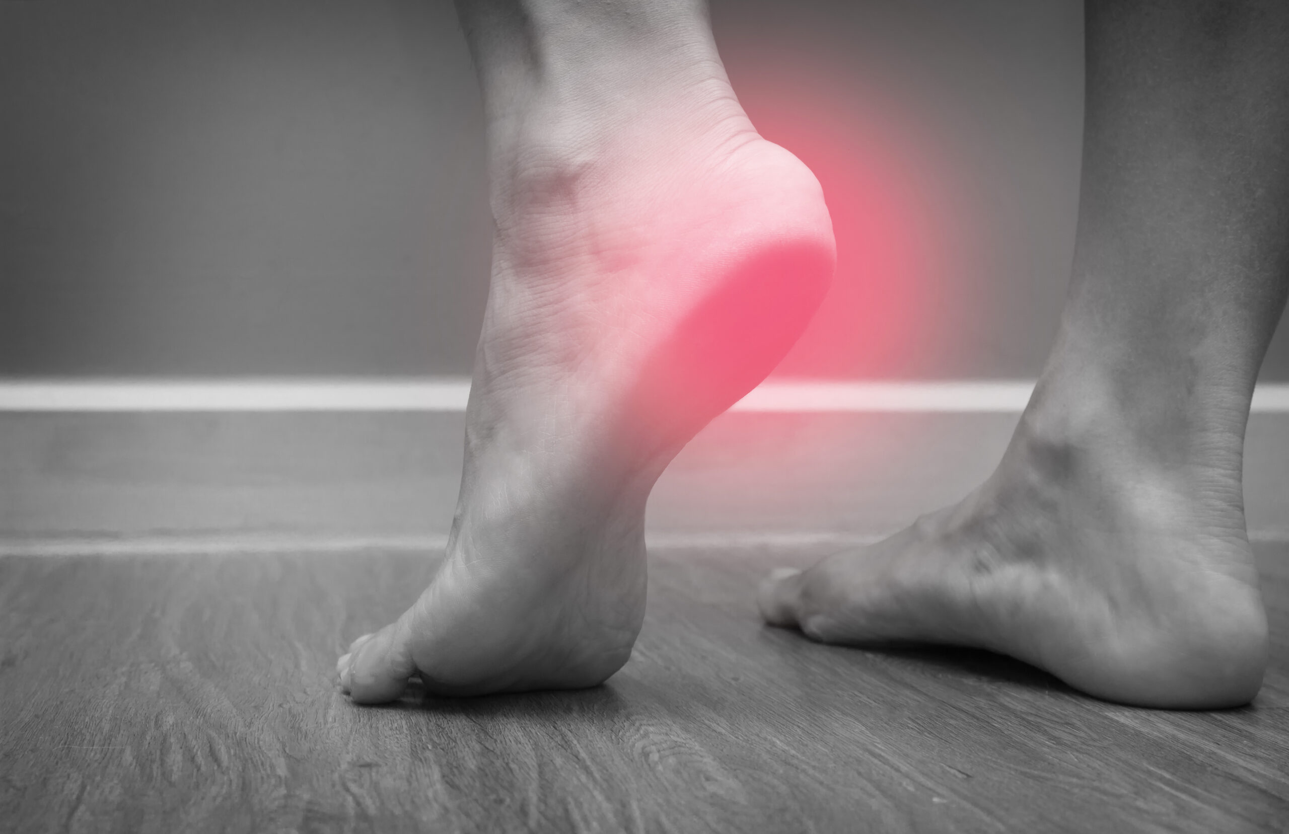足底腱膜炎とは？典型的な症状と原因とファンクショナルインソールの有効性
