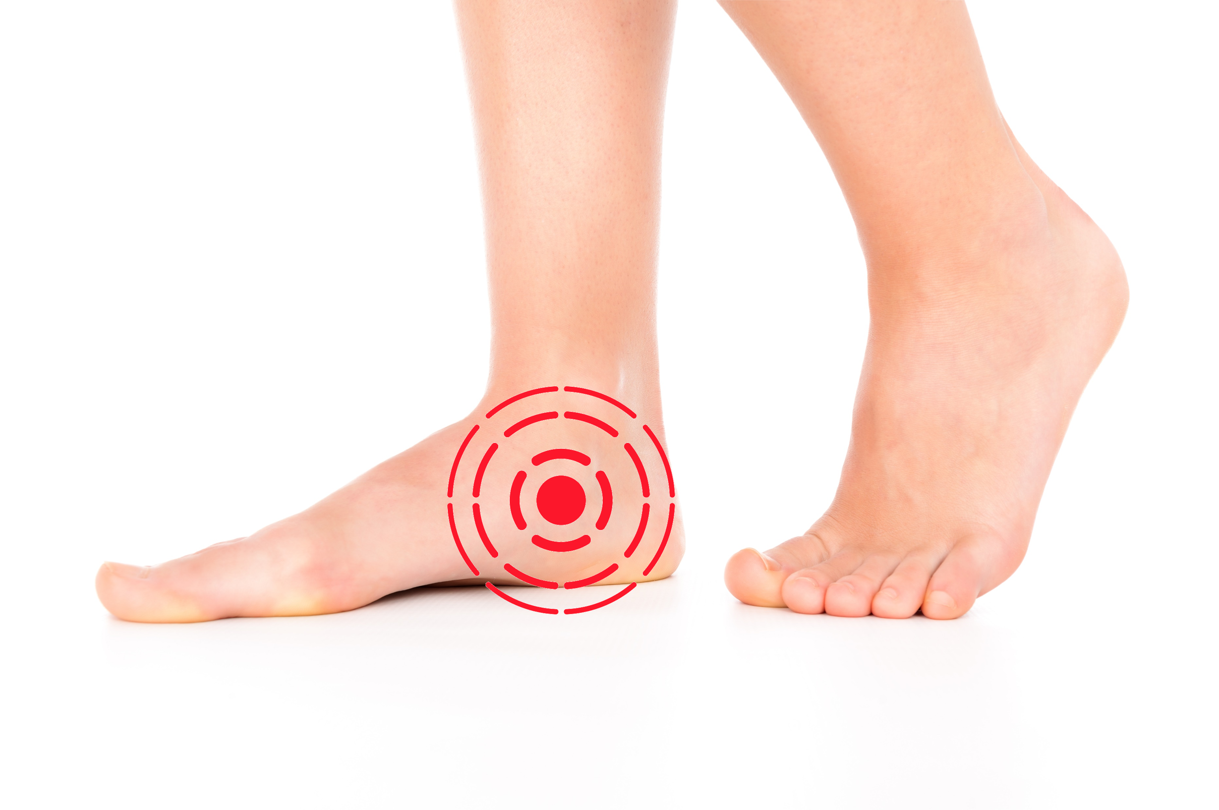 足裏の痛み
後脛骨筋腱機能不全症（PTTD）により痛みが生じる個所
足の悩みは何ですか？