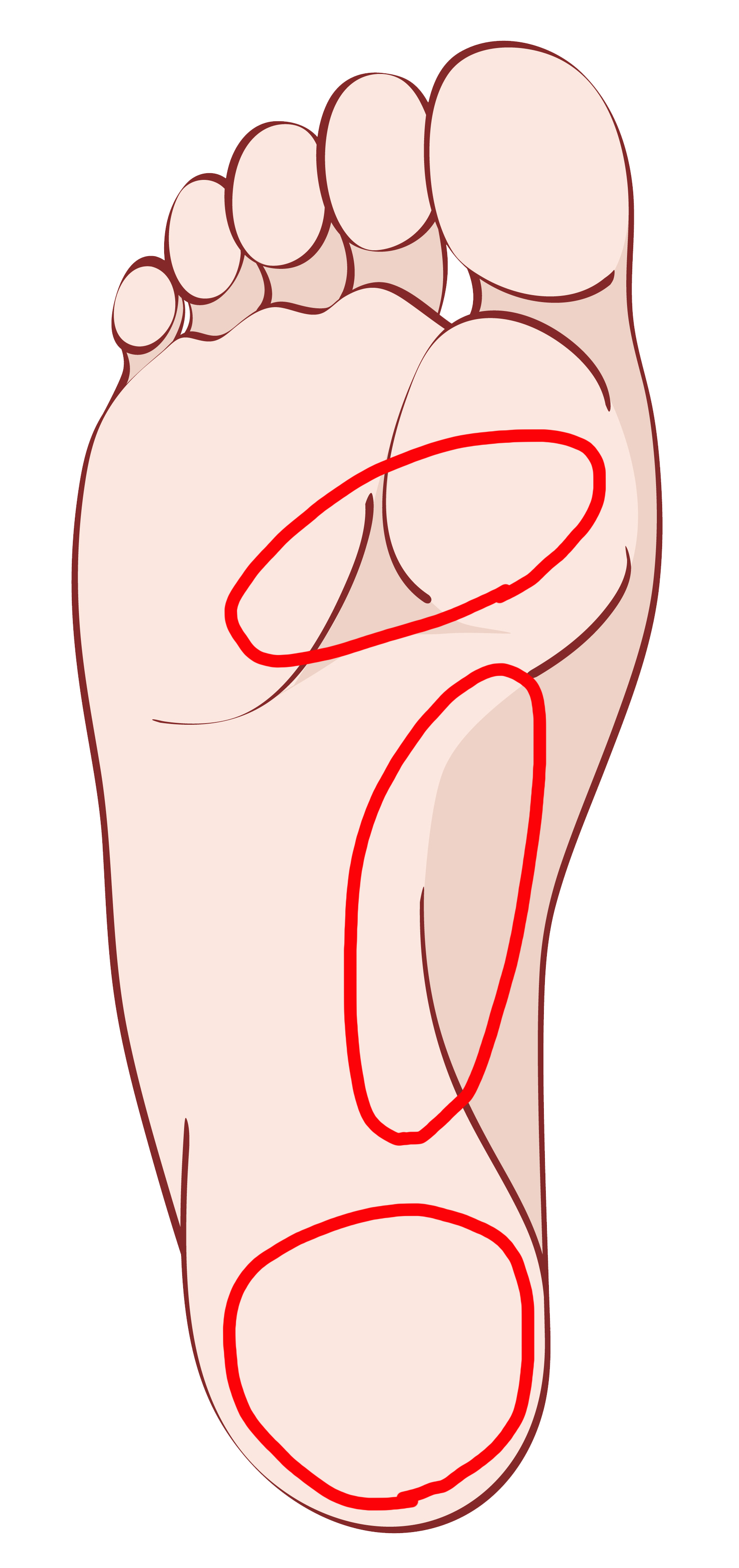 足底筋膜炎の痛みが生じる個所。
かかと部分が最も頻出する箇所となっている。