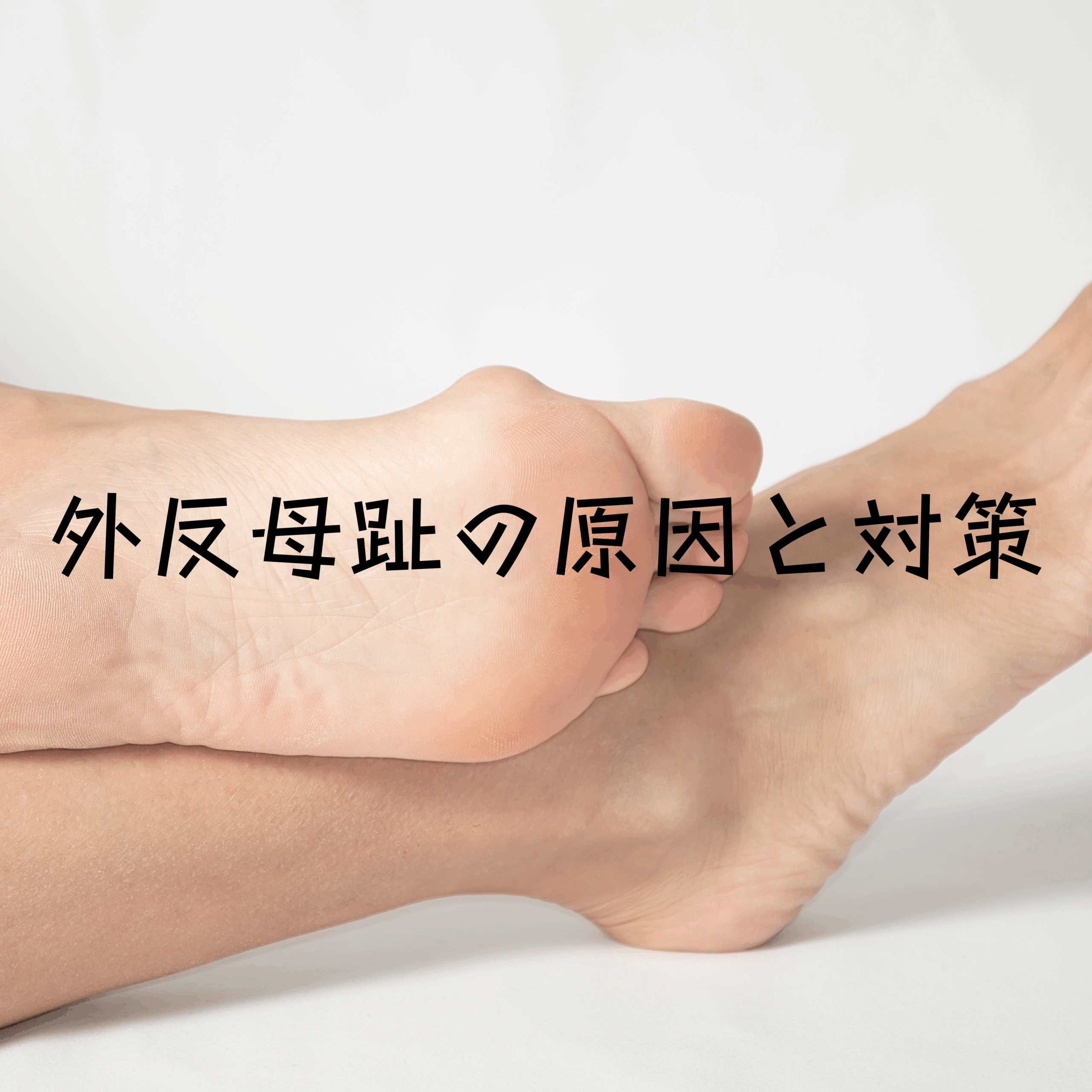 外反母趾の根本的な原因とその対策：NWPLのファンクショナルインソールが最も得意とする領域のひとつ